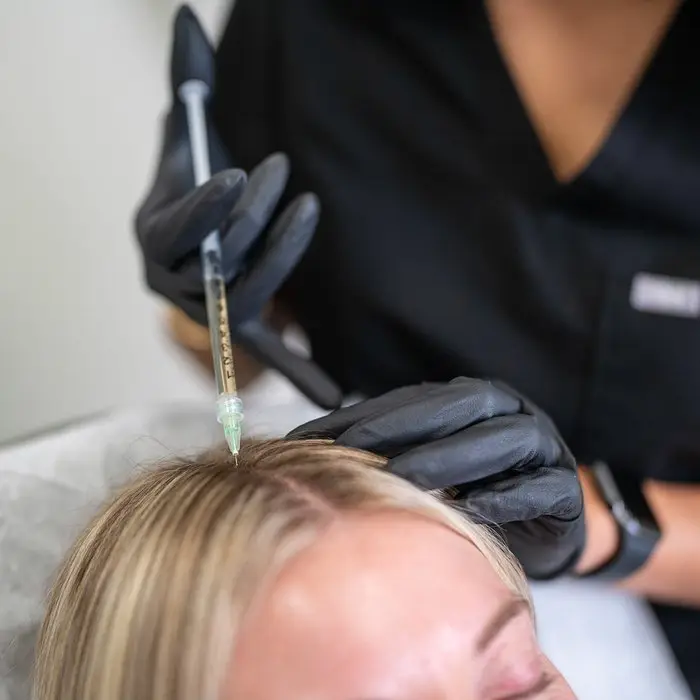 PRP Hair Restoration